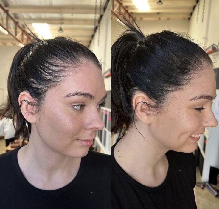 Pourquoi de plus en plus de femmes ont l’impression de perdre leurs cheveux (et ce que personne ne leur explique)