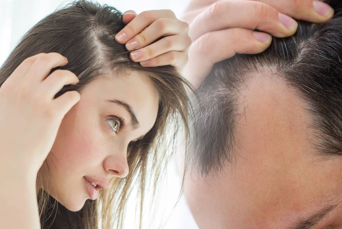 Traitement de l’alopécie : quelles solutions existent selon la cause de la perte de cheveux ?