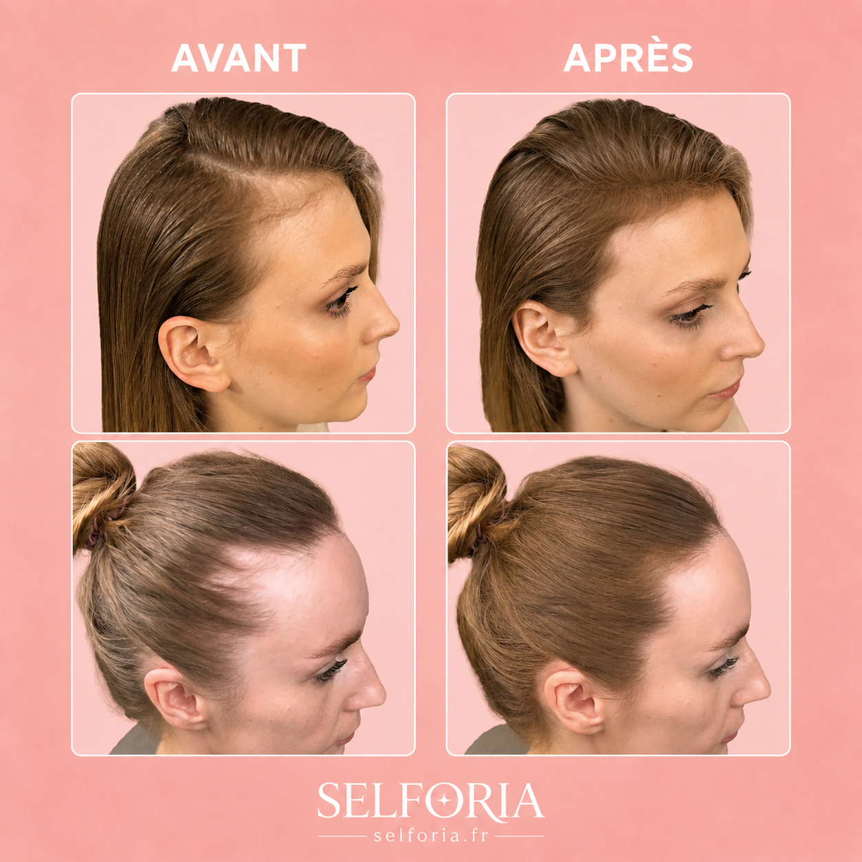 Stylo Correcteur Racines